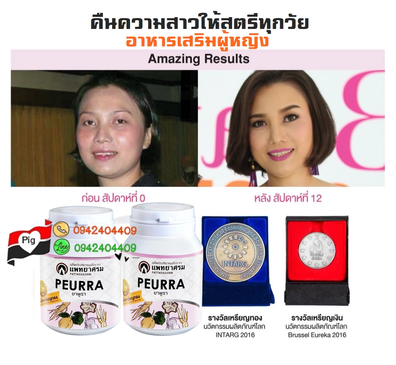 ยาพูรา อาหารเสริมผู้หญิง คืนความสาวให้สตรีทุกวัย