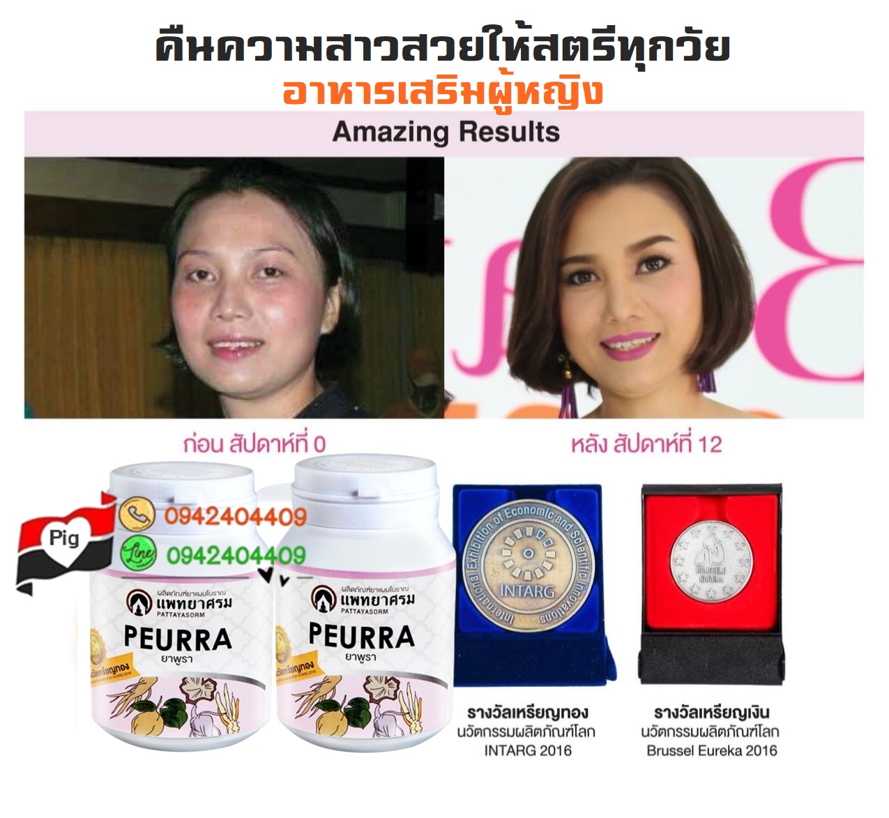 วิตามินเสริมฮอร์โมนผู้หญิง วิตามินผู้หญิง อาหารเสริมภายในผู้หญิง