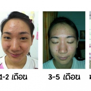 ก่อน-หลังใช้งาน