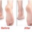 Foot scrub set ที่ขัดส้นเท้าหัวสแตนเลส พร้อมใบมีด แบบกล่องพกพา